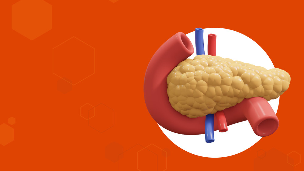 Рак поджелудочной